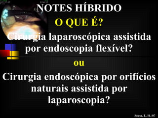 NOTES HÍBRIDO O QUE É? Cirurgia laparoscópica assistida por endoscopia flexível? ou Cirurgia endoscópica por orifícios naturais assistida por laparoscopia? Sousa, L. H. /07 