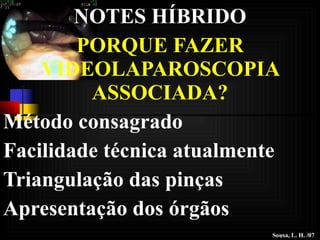 NOTES HÍBRIDO PORQUE FAZER VIDEOLAPAROSCOPIA ASSOCIADA? Método consagrado Facilidade técnica atualmente Triangulação das pinças Apresentação dos órgãos Sousa, L. H. /07 