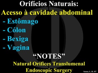 I O Orifícios Naturais: Acesso à cavidade abdominal - Estômago - Cólon - Bexiga - Vagina “ NOTES” Natural Orifices Translumenal Endoscopic Surgery Sousa, L. H. /07 