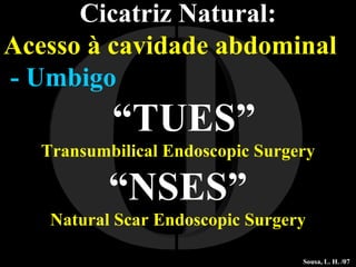 I O Cicatriz Natural: Acesso à cavidade abdominal - Umbigo “ TUES” Transumbilical Endoscopic Surgery “ NSES” Natural Scar Endoscopic Surgery Sousa, L. H. /07 