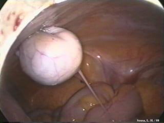 Sousa, L. H. / 98 Sousa, L. H. / 08 