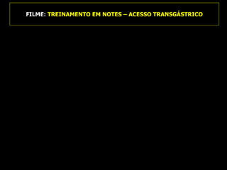 FILME:  TREINAMENTO EM NOTES – ACESSO TRANSGÁSTRICO 
