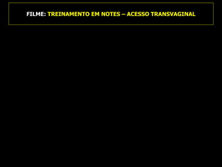 FILME:  TREINAMENTO EM NOTES – ACESSO TRANSVAGINAL 