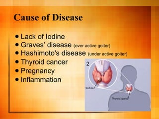 Cause of Disease Lack of Iodine Graves’ disease  (over active goiter) Hashimoto's disease  (under active goiter) Thyroid cancer Pregnancy  Inflammation 2 
