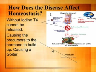 How Does the Disease Affect Homeostasis? 4 3 Causing the precursors to the hormone to build up. Causing a Goiter. Without Iodine T4 cannot be released. 