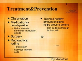 Treatment&Prevention Observation Medications-  Levothyroxine Helps simulate hormones in pituitary glands Surgery Radioactive iodine Taken orally Destroys Thyroid cells Taking a healthy amount of iodine helps prevent goiters Can be taken through iodized salt 7 10 By Minneford 