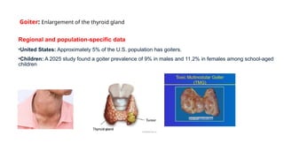 Goiter Approach Comprehensive Overview of Goiter: Classification, Diagnosis, and ...