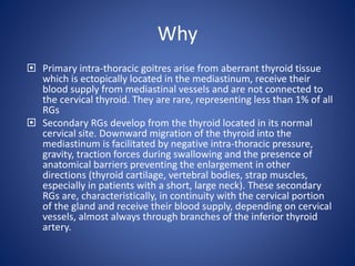 Why
 Primary intra-thoracic goitres arise from aberrant thyroid tissue
which is ectopically located in the mediastinum, receive their
blood supply from mediastinal vessels and are not connected to
the cervical thyroid. They are rare, representing less than 1% of all
RGs
 Secondary RGs develop from the thyroid located in its normal
cervical site. Downward migration of the thyroid into the
mediastinum is facilitated by negative intra-thoracic pressure,
gravity, traction forces during swallowing and the presence of
anatomical barriers preventing the enlargement in other
directions (thyroid cartilage, vertebral bodies, strap muscles,
especially in patients with a short, large neck). These secondary
RGs are, characteristically, in continuity with the cervical portion
of the gland and receive their blood supply, depending on cervical
vessels, almost always through branches of the inferior thyroid
artery.
 