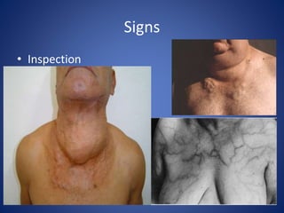 Signs
• Inspection
 