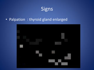 Signs
• Palpation : thyroid gland enlarged
 