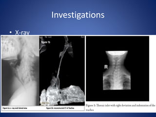 Investigations
• X-ray
 