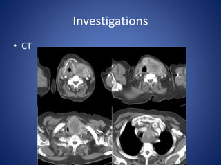 Investigations
• CT
 