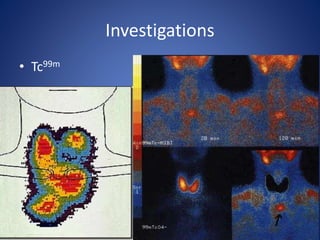 Investigations
• Tc99m
 