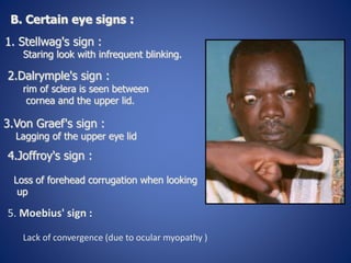B. Certain eye signs :
1. Stellwag's sign :
Staring look with infrequent blinking.
2.Dalrymple's sign :
rim of sclera is seen between
cornea and the upper lid.
3.Von Graef's sign :
Lagging of the upper eye lid
4.Joffroy's sign :
Loss of forehead corrugation when looking
up
5. Moebius' sign :
Lack of convergence (due to ocular myopathy )
 