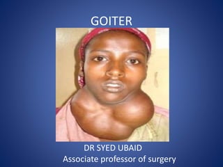 GOITER
DR SYED UBAID
Associate professor of surgery
 