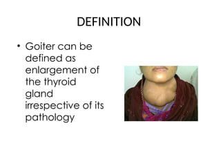 GOITRES_General overview_Clinical presentation and Approach to ...