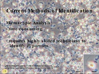 Current Methods of Identification   Microscopic Analysis: - time consuming - requires highly skilled technicians to identify  P. parvum Light micrograph (phase contrast) of a water sample, containing predominantly Prymnesium parvum , collected from Lake Koronia on 11th September, 2004. Inset: Motile  P. parvum  cell with visible flagellae and haptonema. Bars indicate 10 μm; inset 5 μm. 