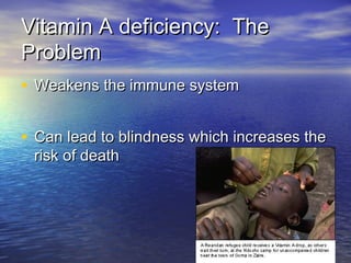Vitamin A deficiency: TheVitamin A deficiency: The
ProblemProblem
• Weakens the immune systemWeakens the immune system
• Can lead to blindness which increases theCan lead to blindness which increases the
risk of deathrisk of death
 