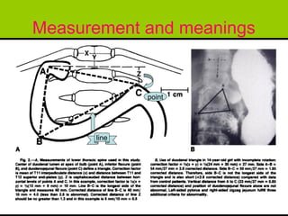 Measurement and meanings


             point




      line
 