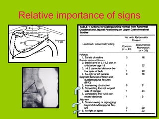 Relative importance of signs
 