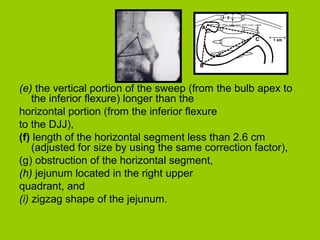 (e) the vertical portion of the sweep (from the bulb apex to
    the inferior flexure) longer than the
horizontal portion (from the inferior flexure
to the DJJ),
(f) length of the horizontal segment less than 2.6 cm
    (adjusted for size by using the same correction factor),
(g) obstruction of the horizontal segment,
(h) jejunum located in the right upper
quadrant, and
(i) zigzag shape of the jejunum.
 