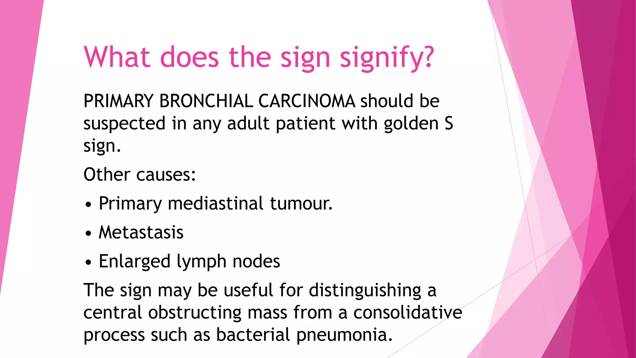 What does the sign signify?
PRIMARY BRONCHIAL CARCINOMA should be
suspected in any adult patient with golden S
sign.
Other causes:
• Primary mediastinal tumour.
• Metastasis
• Enlarged lymph nodes
The sign may be useful for distinguishing a
central obstructing mass from a consolidative
process such as bacterial pneumonia.