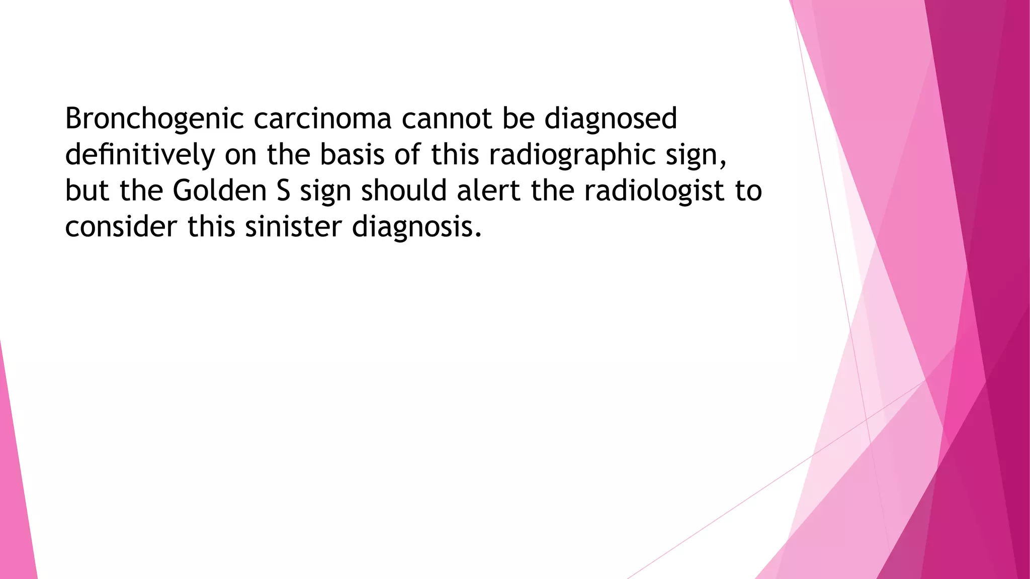Bronchogenic carcinoma cannot be diagnosed
definitively on the basis of this radiographic sign,
but the Golden S sign should alert the radiologist to
consider this sinister diagnosis.