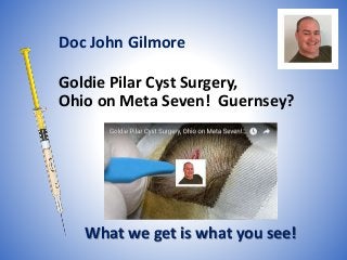 Goldie Pilar Cyst Surgery,
Ohio on Meta Seven! Guernsey?
What we get is what you see!
Doc John Gilmore
 