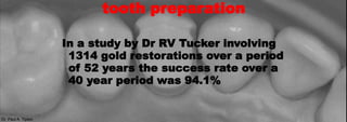 Dr. Paul A. Tipton
In a study by Dr RV Tucker involving
1314 gold restorations over a period
of 52 years the success rate over a
40 year period was 94.1%
Dr. Paul A. Tipton
tooth preparation
 
