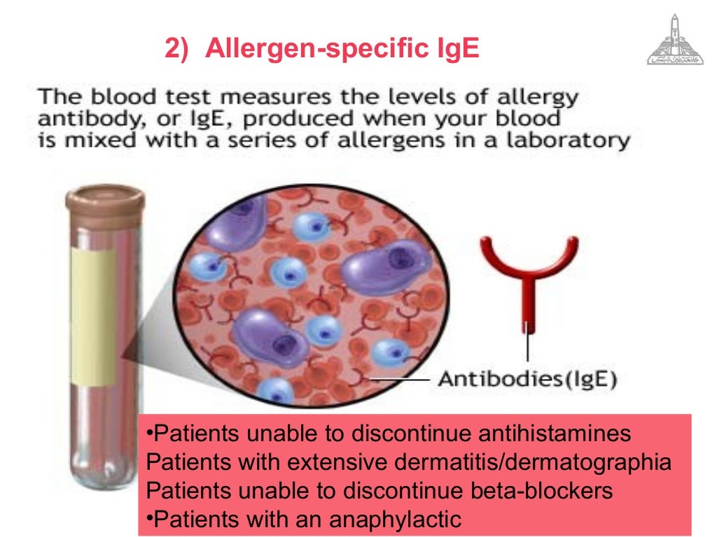 Gold standards in allergy diagnosis