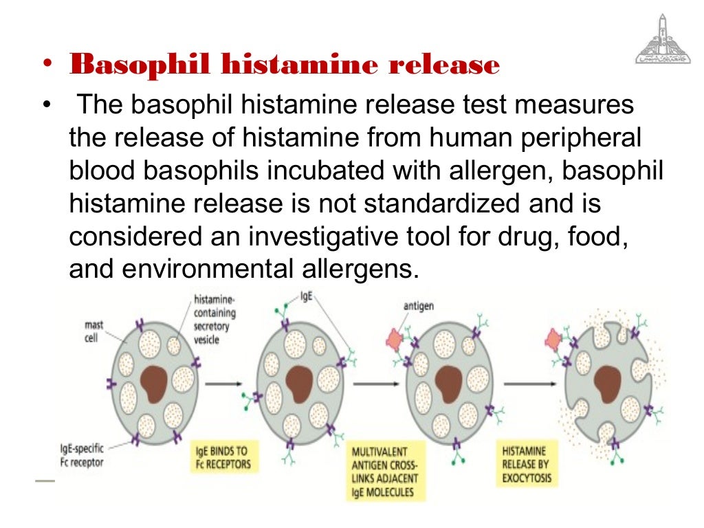 Gold standards in allergy diagnosis