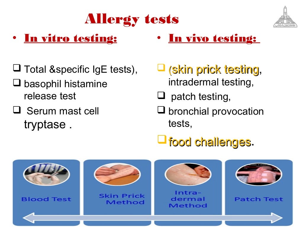 Gold standards in allergy diagnosis