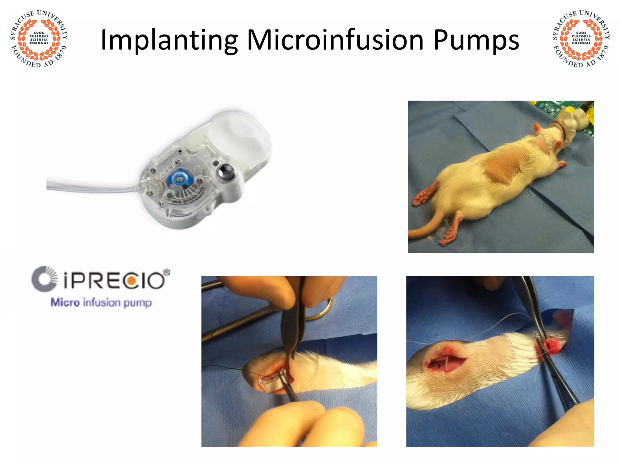 Implanting Microinfusion Pumps
 
