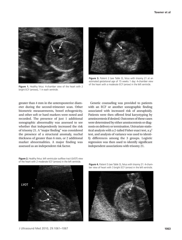 Single Versus Multiple Echogenic Foci in the Fetal Heart | PDF