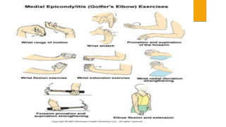 Golfer elbow.pptx