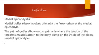 Golfer elbow
Medial epicondylitis:
Medial golfer elbow involves primarily the flexor origin at the medial
epicondyle.
The pain of golfer elbow occurs primarily where the tendon of the
forearms muscles attach to the bony bump on the inside of the elbow
(medial epicondyle)
.
 