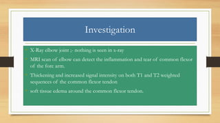 Investigation
• X-Ray elbow joint ;- nothing is seen in x-ray
• MRI scan of elbow can detect the inflammation and tear of common flexor
of the fore arm.
• Thickening and increased signal intensity on both T1 and T2 weighted
sequences of the common flexor tendon
• soft tissue edema around the common flexor tendon.
 