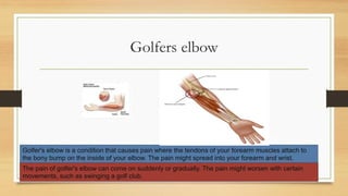 Golfers elbow
Golfer's elbow is a condition that causes pain where the tendons of your forearm muscles attach to
the bony bump on the inside of your elbow. The pain might spread into your forearm and wrist.
The pain of golfer's elbow can come on suddenly or gradually. The pain might worsen with certain
movements, such as swinging a golf club.
 