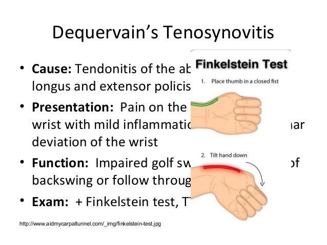 Back To The Swing Of Things Golf Injury