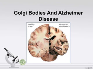 Golgi Bodies And Alzheimer
Disease
 