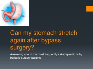 Can my stomach stretch
again after bypass
surgery?
Answering one of the most frequently asked questions by
bariatric surgery patients
 