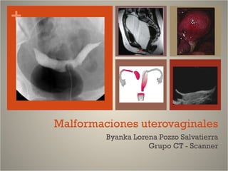Malformaciones uterovaginales Byanka Lorena Pozzo Salvatierra Grupo CT - Scanner 