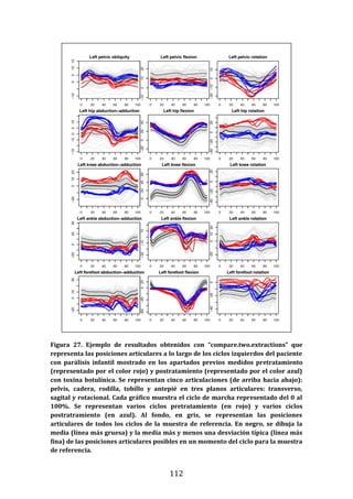 112
Figura 27. Ejemplo de resultados obtenidos con “compare.two.extractions” que
representa las posiciones articulares a lo largo de los ciclos izquierdos del paciente
con parálisis infantil mostrado en los apartados previos medidos pretratamiento
(representado por el color rojo) y postratamiento (representado por el color azul)
con toxina botulínica. Se representan cinco articulaciones (de arriba hacia abajo):
pelvis, cadera, rodilla, tobillo y antepié en tres planos articulares: transverso,
sagital y rotacional. Cada gráfico muestra el ciclo de marcha representado del 0 al
100%. Se representan varios ciclos pretratamiento (en rojo) y varios ciclos
postratramiento (en azul). Al fondo, en gris, se representan las posiciones
articulares de todos los ciclos de la muestra de referencia. En negro, se dibuja la
media (línea más gruesa) y la media más y menos una desviación típica (línea más
fina) de las posiciones articulares posibles en un momento del ciclo para la muestra
de referencia.
 