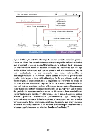 36
Figura 2: Etiología de la PCI a lo largo del neurodesarrollo. Existen 2 grandes
causas de PCI en función del momento en el que se produce el evento dañino
que provoca el problema motor. Si la lesión ocurre antes de las 24 semanas,
las consecuencias sobre el sistema nervioso en desarrollo son de tipo
malformativo y dependen del tipo de proceso del neurodesarrollo que se
esté produciendo en ese momento (en rosa): microcefalia o
hemimegalencefalia si el evento lesivo ocurre durante la proliferación
celular, heterotopia o lisencefalia si la migración de neuroblastos se altera o
polimicrogiria o esquisencefalia si la organización neocortical se altera en
las fases iniciales de la misma. A partir de las 24 semanas, las consecuencias
sobre el sistema nervioso en desarrollo son de tipo defectivo (desaparecen
estructuras lesionadas y aparece una cicatriz o un quiste) y a su vez depende
del periodo del neurodesarrollo. Ante de las 36 semanas, la sustancia blanca
es particularmente sensible y alteraciones en el neurodesarrollo normal
pueden producir leucomalacia periventricular y/o hemorragias
priventriculares. A partir de las 36 semanas, la sustancia gris es más sensible
por un aumento de los procesos normales de desarrollo que ocurren en ese
momento haciéndola sensible a las lesiones producidas por la encefalopatía
hipóxico-isquémica o por los infartos. Basada en Staudt et al.37
Proliferación celular
Migración de neuroblastos
Organización neocor cal
Organización de sustancia blanca
Microcefalia
Hemimegalencefalia
Heterotopia
Lisencefalia
24 36 40 à
Polimicrogiria
Esquisencefalia
MALFORMACIONES LESIONES DEFECTIVAS
Edad gestacional en semanas
Leucomalacia
periventricular
Hemorragia
periventricular
Encefalopa a
hipóxico-isquémica
Infartos
 