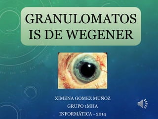 GRANULOMATOS 
IS DE WEGENER 
XIMENA GOMEZ MUÑOZ 
GRUPO 1MHA 
INFORMÁTICA - 2014 
 