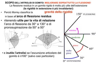 SCOPO DELL ARTROLISI DI GOMITO: MIGLIORARE SOPRATTUTTO LA FLESSIONE!
La flessione residua in un gomito rigido è molto più utile dell estensione
(la rigidità in estensione è più invalidante!)

gravità della rigidità
in base all arco di flessione residua
•  ritenendo utile per la vita di relazione
l arco di flessione da 30° a 130° e di
pronosupinazione da 50° a 50°
•  Perciò Morrey classifica la

•  e inutile l artrolisi se l escursione articolare del
gomito è ≥100° (salvo casi particolari)

 
