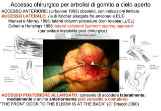 Accesso chirurgico per artrolisi di gomito a cielo aperto
ACCESSO ANTERIORE: (Urbaniak 1985) obsoleto, con indicazioni limitate
ACCESSO LATERALE: via di Kocher allargata fra anconeo e EUC
Mansat e Morrey 1998: lateral column procedure (con release LUCL)
Cohen e Hansings 1998: lateral collateral ligament sparing approach
(per evitare instabilità post chirurgica)

ACCESSO POSTERIORE ALLARGATO: consente di accedere lateralmente,
medialmente e anche anteriormente (più versatile e completo)
THE FRONT DOOR TO THE ELBOW IS AT THE BACK (O Driscoll 2000)

 