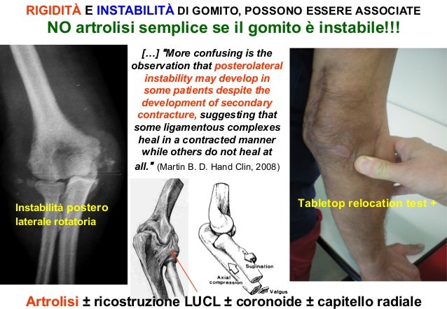 Ab Roller Con Rimbalzo Automatico - Rullo Addominali A 4 Ruote Per Allenamento Core - Foto 10