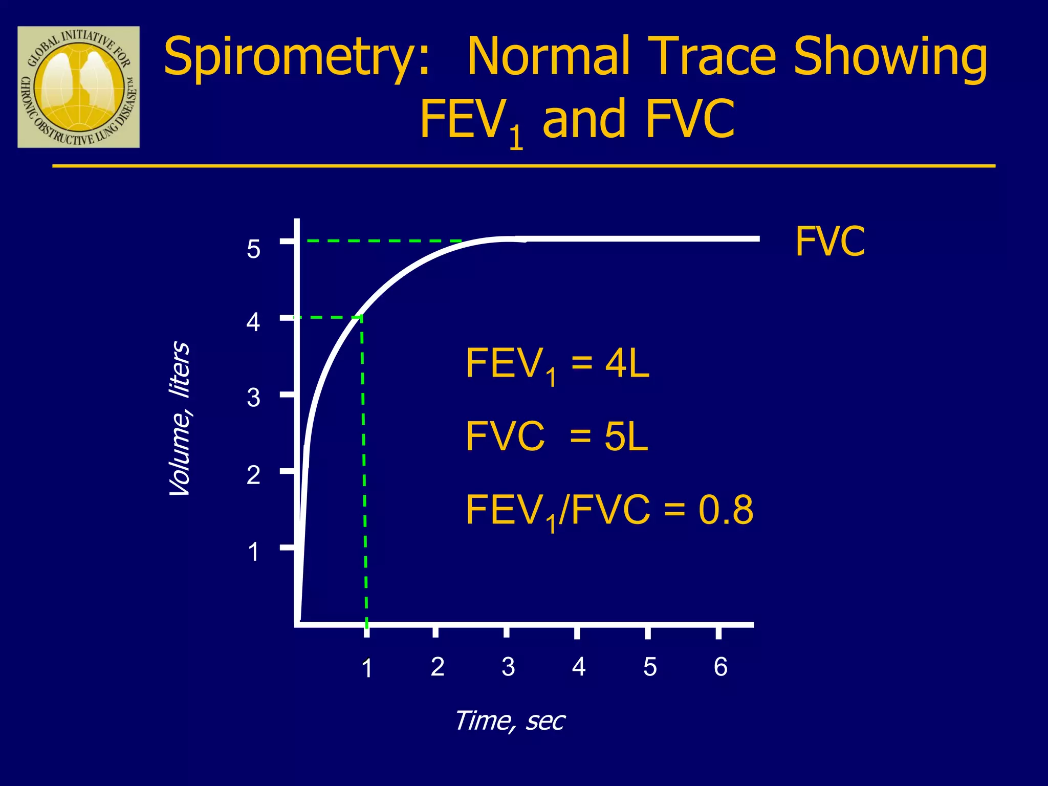 Spirometry: Normal Trace Showing
FEV1 and FVC
1 2 3 4 5 6
1
2
3
4
Volume,liters
Time, sec
FVC5
1
FEV1 = 4L
FVC = 5L
FEV1/FVC = 0.8
 