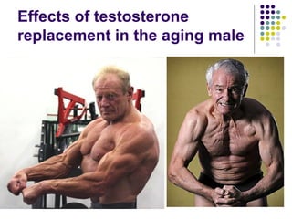 Effects of testosterone replacement in the aging male 